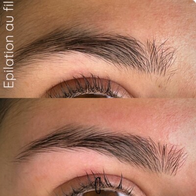 epilation au fil fos sur mer