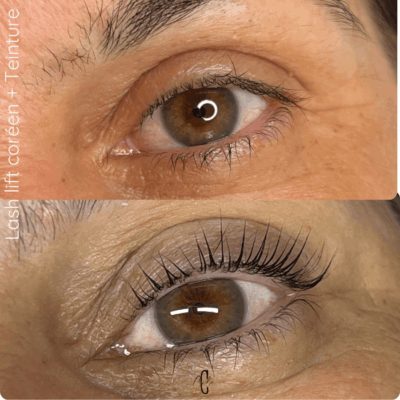 korean lift korean lift