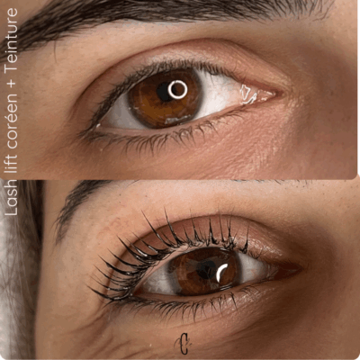 korean lift salon de provence 13 korean lift salon de provence 13