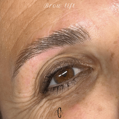 brow lift fos